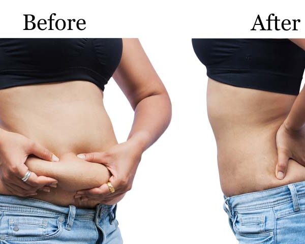 Alternative view of AMC Magnetic Slimmer Belt